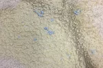 59316-berdell-mastitis.jpg