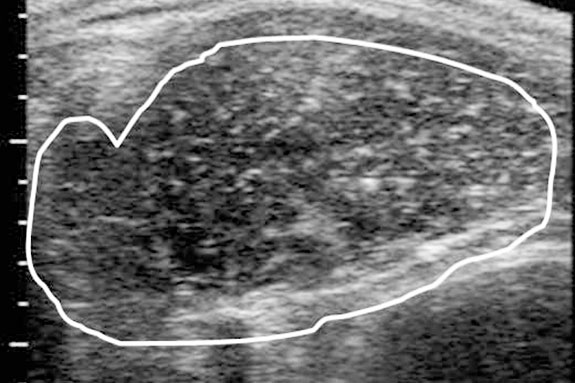 Ultrasound of a ribeye