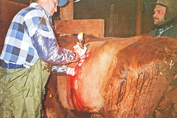 Cesarean section in progress