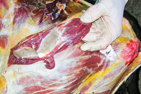 The injection site reaction of an intramuscular (IM) injection of a subcutaneous product 10 days after injection