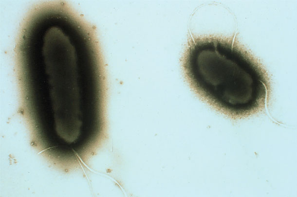 Transmission electron of Pseudomonas fluorescens
