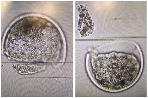A biopsied cell has been removed from the embryo 