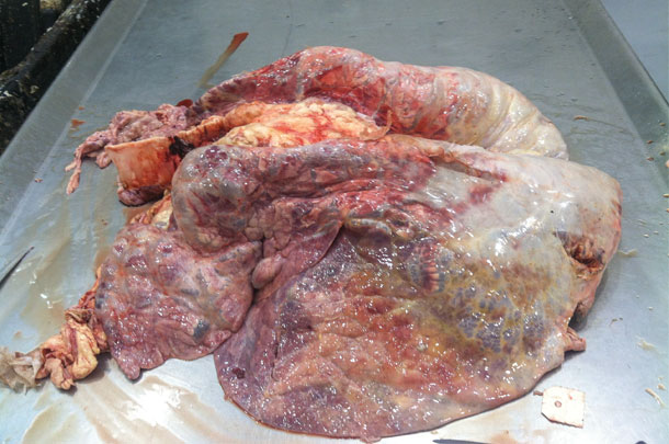 diseased lung
