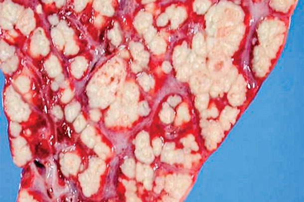 Autopsy photo