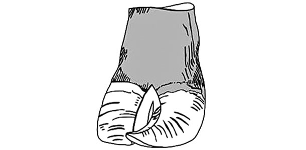 corkscrew hoof