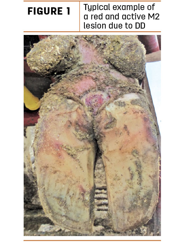 Typical example of a red and active M2 lesion due to DD