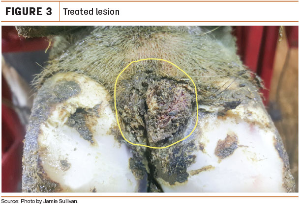 Treated lesion