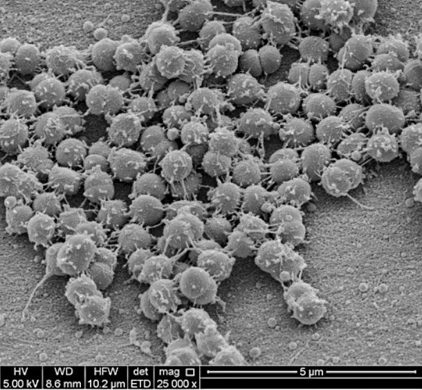 M. bovoculi magnified 25,000 X.