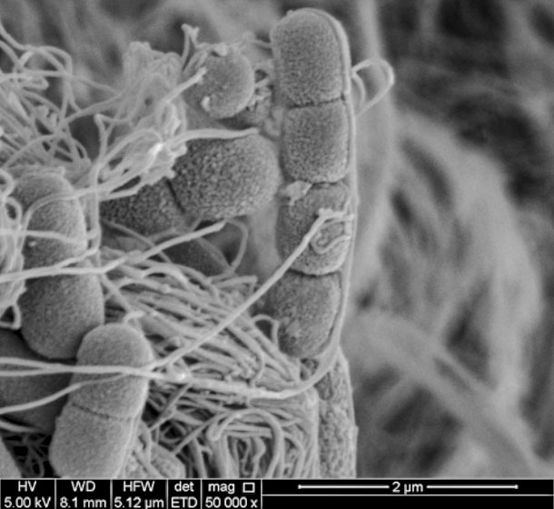 M. bovis and M. bovoculi mangnified 50,000 X