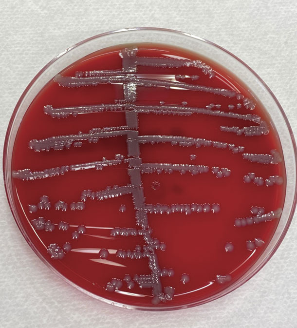 E. coli bacteria growing 
